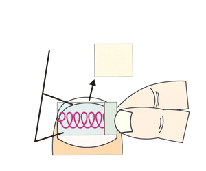 Paste the cover over the block.