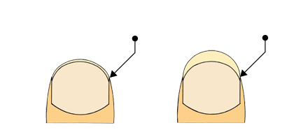 Nails Preparation 1-1