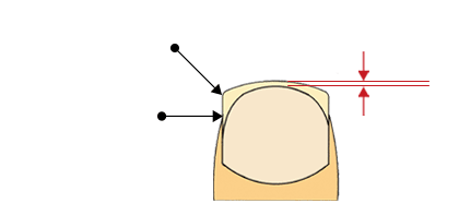 Nails Preparation 2-1
