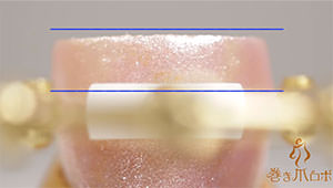 Correcting the nail